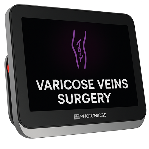 Diode laser rental For Varicose Veins Surgery Manufacturers in Ahmedabad